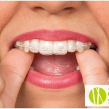 ¿Que es la ortodoncia y como puede ayudarnos? (Parte 2)