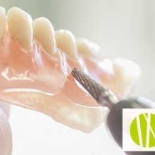 Implantes dentales, beneficios y dudas