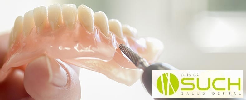 Implantes dentales, beneficios y dudas