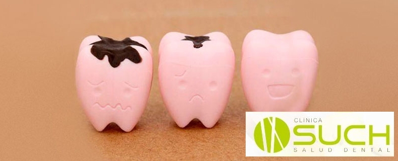 ¿Cómo prevenir las caries y evitar el deterioro dental? 
