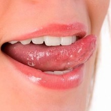 La limpieza lingual en la salud bucodental