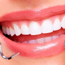 El exceso de piezas dentales: la hiperdoncia