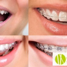 ¿Que es la ortodoncia y como puede ayudarnos? (Parte 1)
