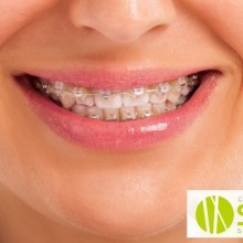 ¿Que es la ortodoncia y como puede ayudarnos? (Parte 3)